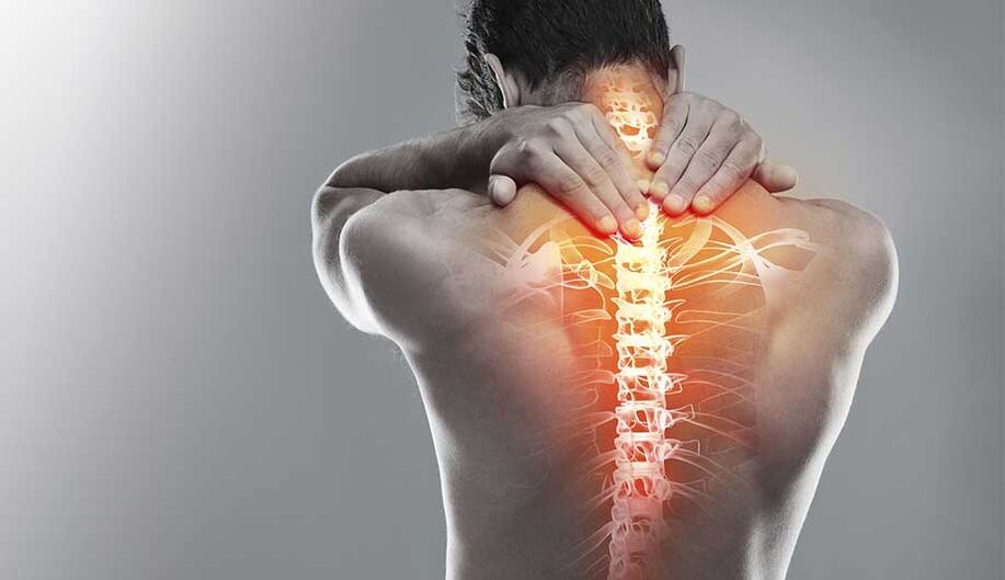 Osteochondroza gâtului