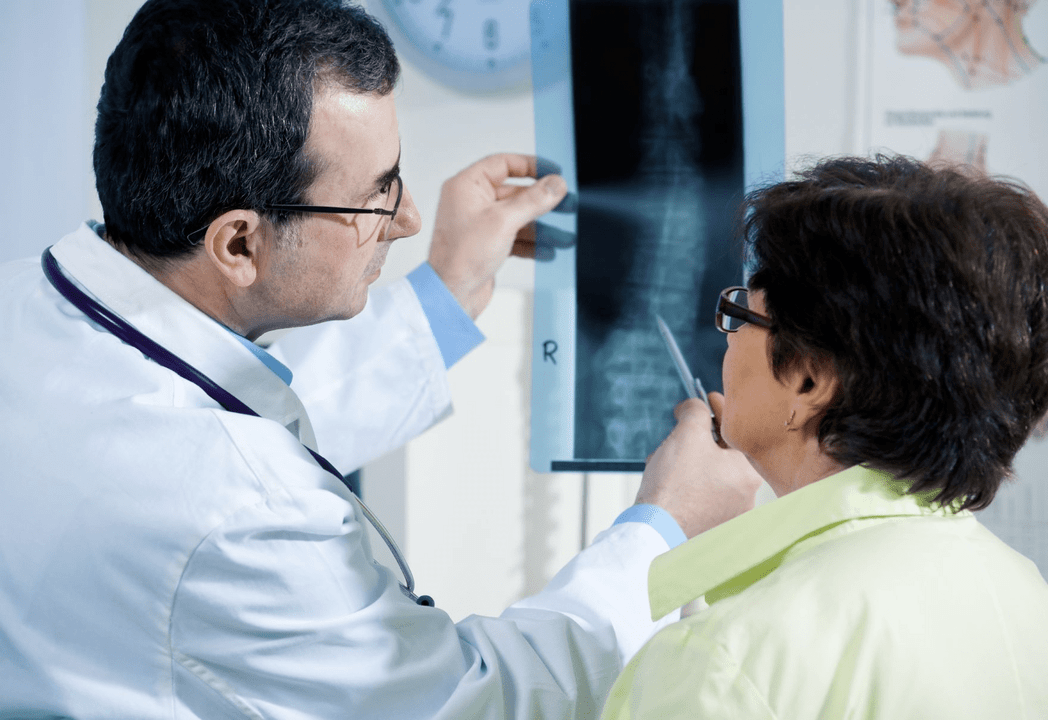 Un neurolog diagnostichează osteocondroza folosind radiografia coloanei vertebrale