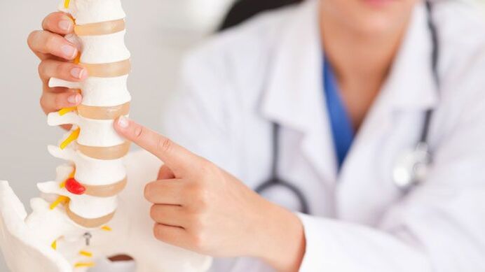 explicația osteocondrozei lombare pe un model al coloanei vertebrale