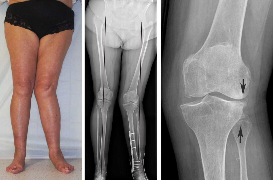 cum să tratezi